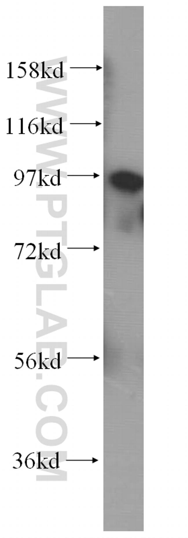 golgin 97 Antibody in Western Blot (WB)