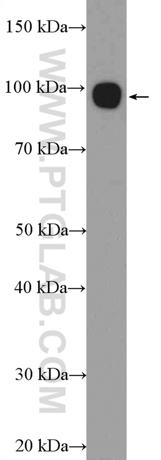 golgin 97 Antibody in Western Blot (WB)