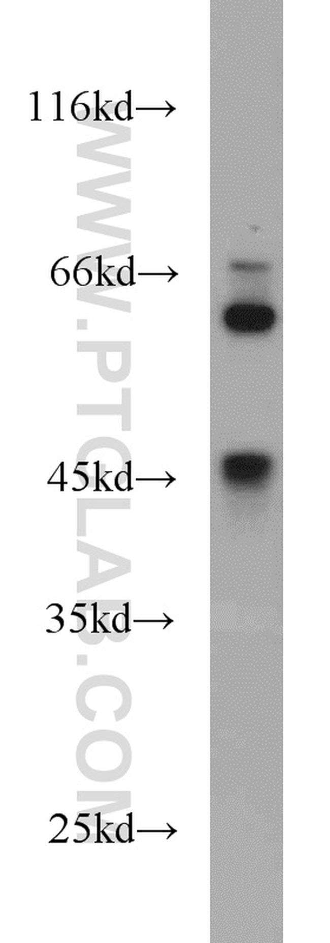 Synaptotagmin-4 Antibody in Western Blot (WB)