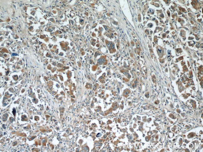 WDR16 Antibody in Immunohistochemistry (Paraffin) (IHC (P))