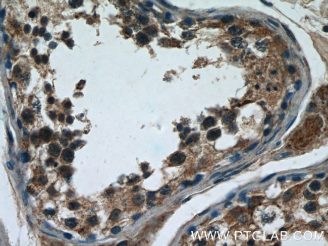 WDR16 Antibody in Immunohistochemistry (Paraffin) (IHC (P))