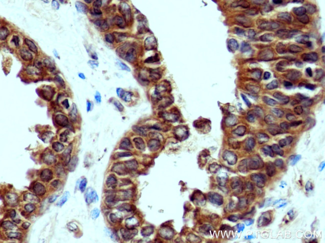 GlnRS Antibody in Immunohistochemistry (Paraffin) (IHC (P))