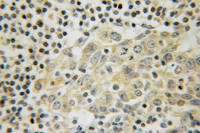 LANCL1 Antibody in Immunohistochemistry (Paraffin) (IHC (P))