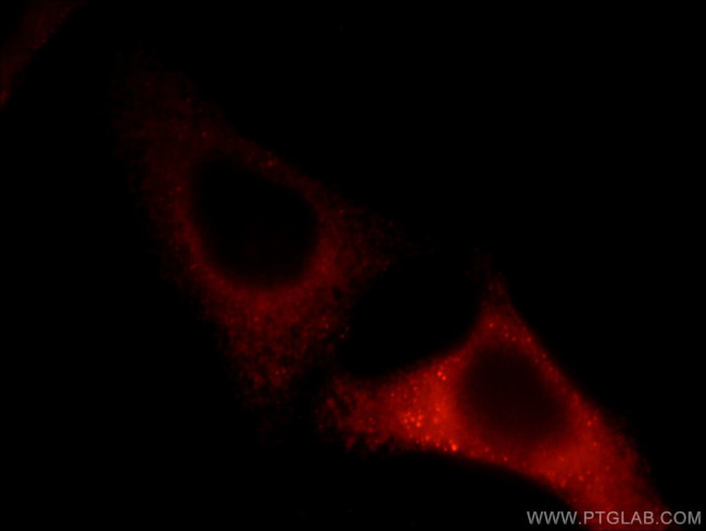 TCIRG1 Antibody in Immunocytochemistry (ICC/IF)