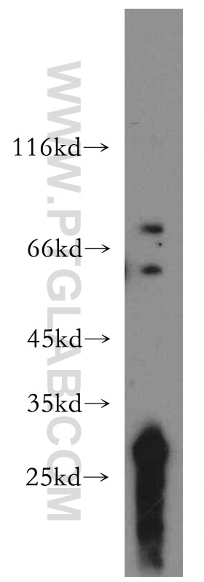 TCIRG1 Antibody in Western Blot (WB)