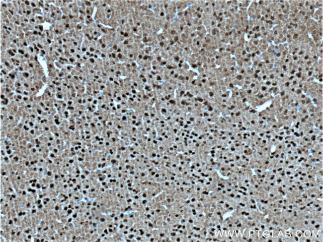 SIAH2 Antibody in Immunohistochemistry (Paraffin) (IHC (P))