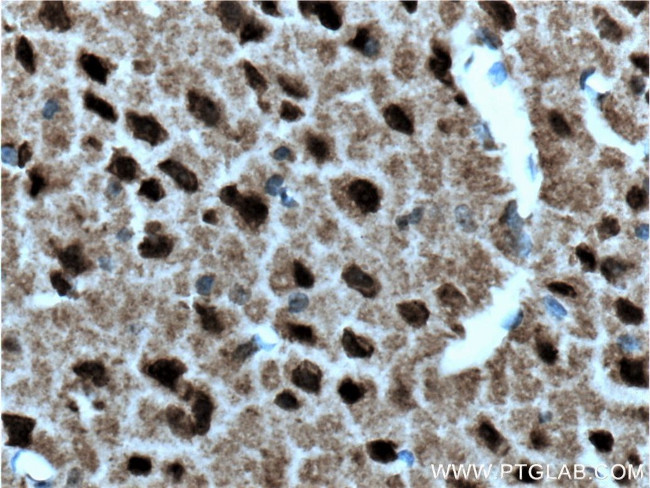 SIAH2 Antibody in Immunohistochemistry (Paraffin) (IHC (P))