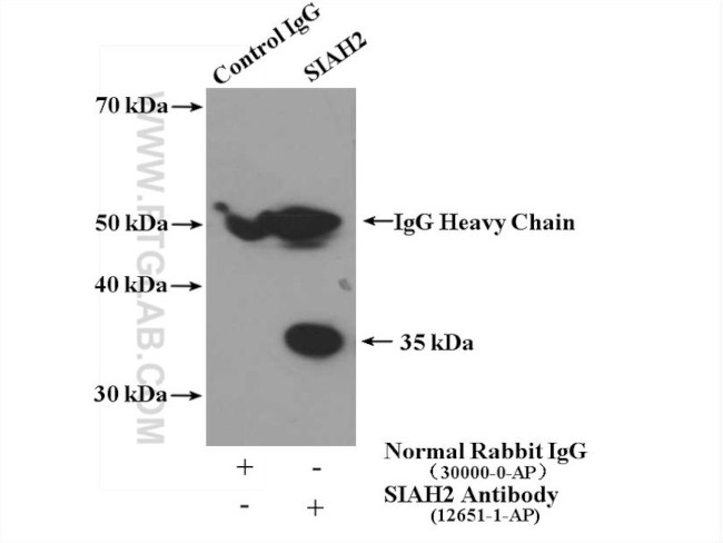 SIAH2 Antibody in Immunoprecipitation (IP)