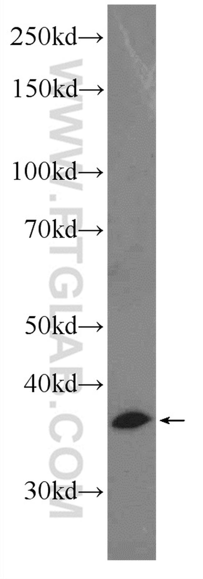 SIAH2 Antibody in Western Blot (WB)