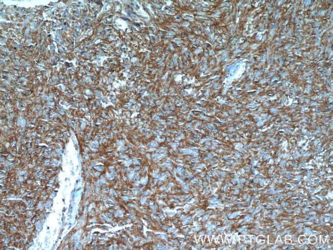 TMEM16A/DOG1 Antibody in Immunohistochemistry (Paraffin) (IHC (P))