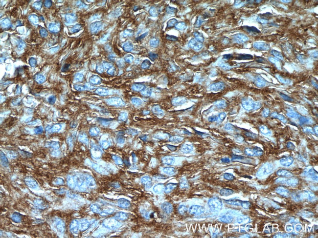 TMEM16A/DOG1 Antibody in Immunohistochemistry (Paraffin) (IHC (P))