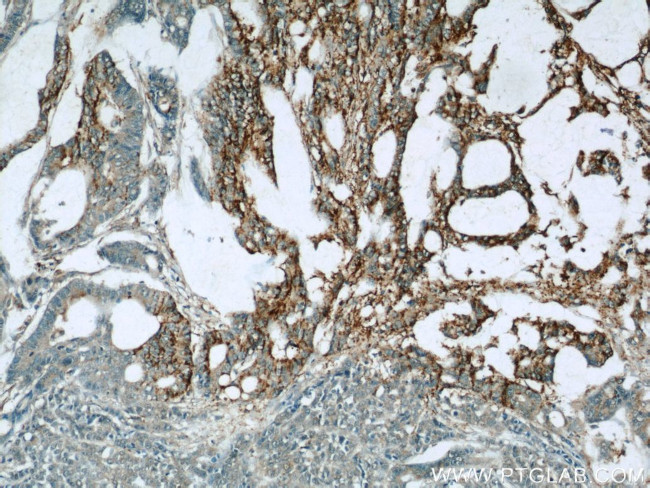 TMEM16A/DOG1 Antibody in Immunohistochemistry (Paraffin) (IHC (P))