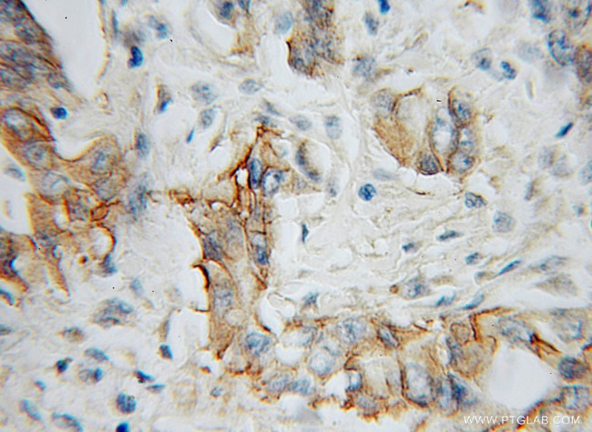 IL5RA Antibody in Immunohistochemistry (Paraffin) (IHC (P))