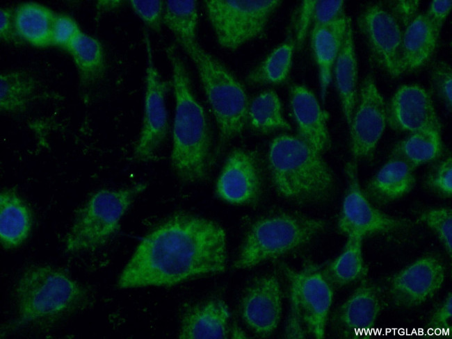 P4HA1 Antibody in Immunocytochemistry (ICC/IF)