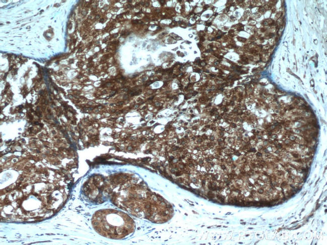 P4HA1 Antibody in Immunohistochemistry (Paraffin) (IHC (P))