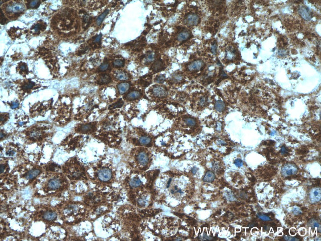 P4HA1 Antibody in Immunohistochemistry (Paraffin) (IHC (P))