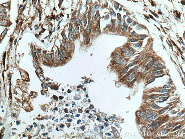 P4HA1 Antibody in Immunohistochemistry (Paraffin) (IHC (P))