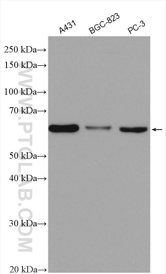 P4HA1 Antibody in Western Blot (WB)