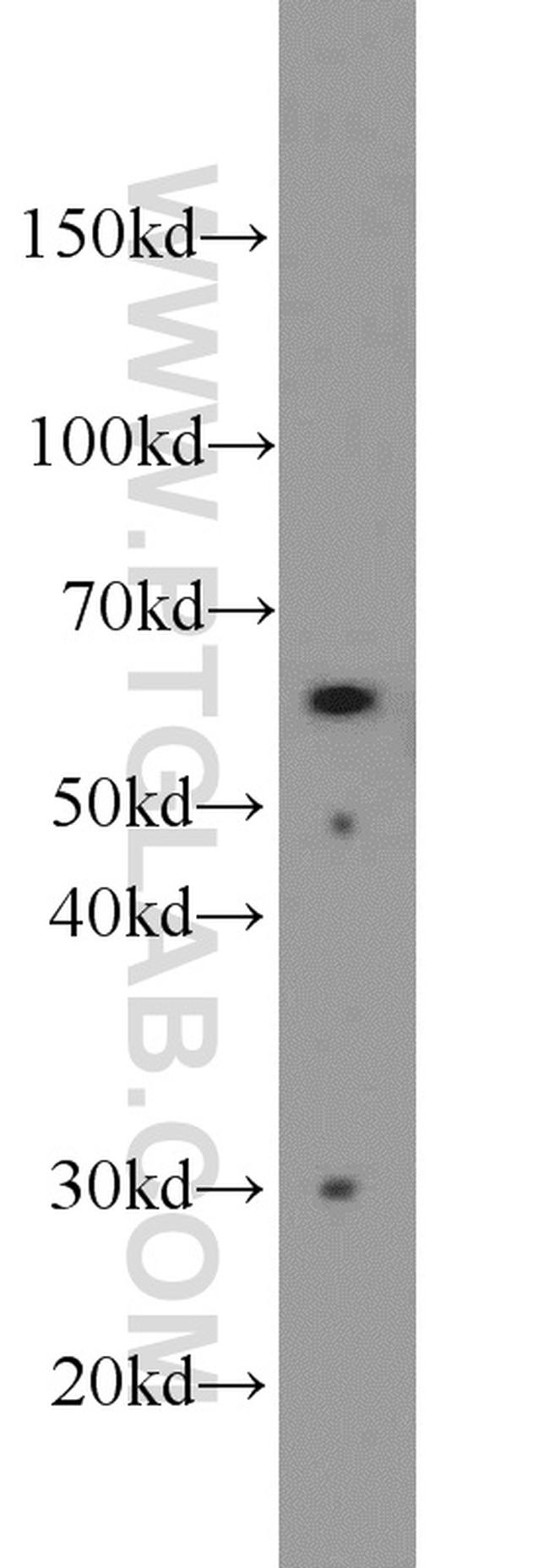 P4HA1 Antibody in Western Blot (WB)