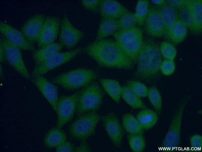 IkB beta Antibody in Immunocytochemistry (ICC/IF)