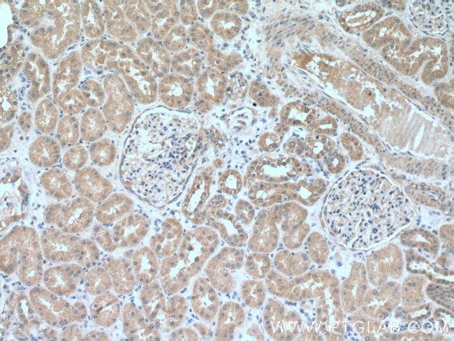 IkB beta Antibody in Immunohistochemistry (Paraffin) (IHC (P))