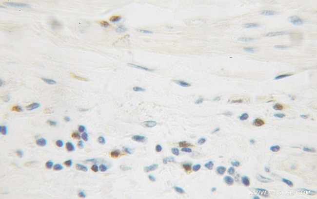 IkB beta Antibody in Immunohistochemistry (Paraffin) (IHC (P))