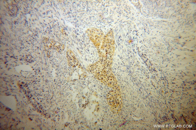 IkB beta Antibody in Immunohistochemistry (Paraffin) (IHC (P))