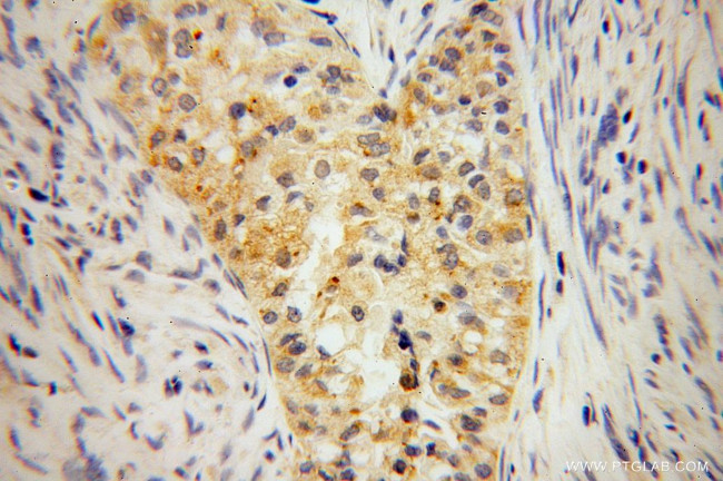 IkB beta Antibody in Immunohistochemistry (Paraffin) (IHC (P))