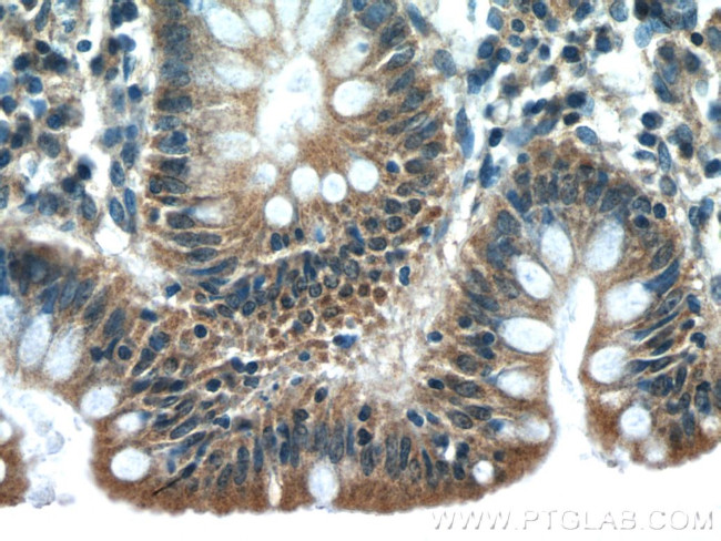 IkB beta Antibody in Immunohistochemistry (Paraffin) (IHC (P))