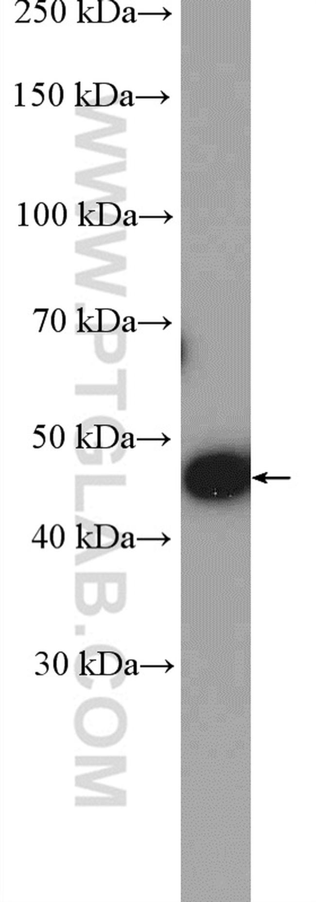 IkB beta Antibody in Western Blot (WB)