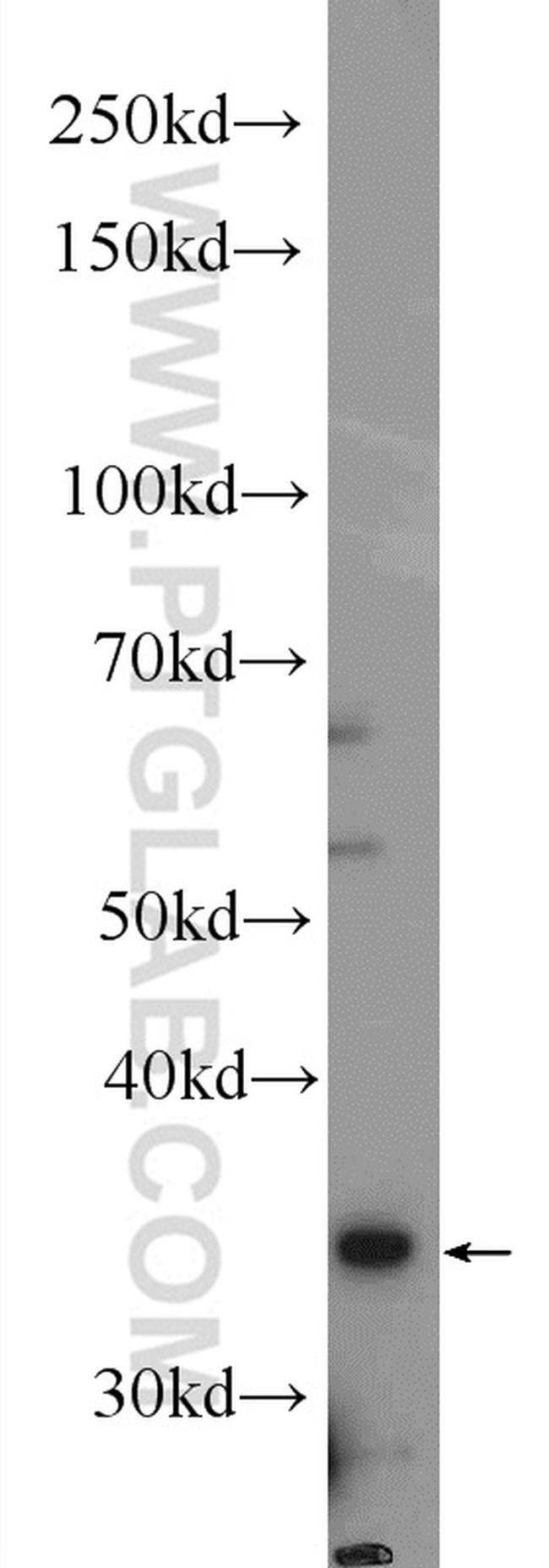 DBP Antibody in Western Blot (WB)