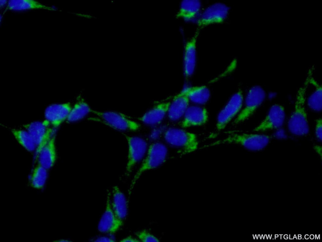 IMP5 Antibody in Immunocytochemistry (ICC/IF)