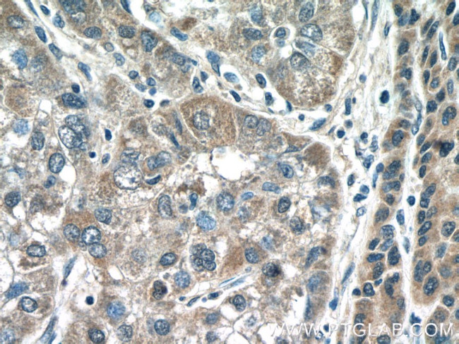 IMP5 Antibody in Immunohistochemistry (Paraffin) (IHC (P))