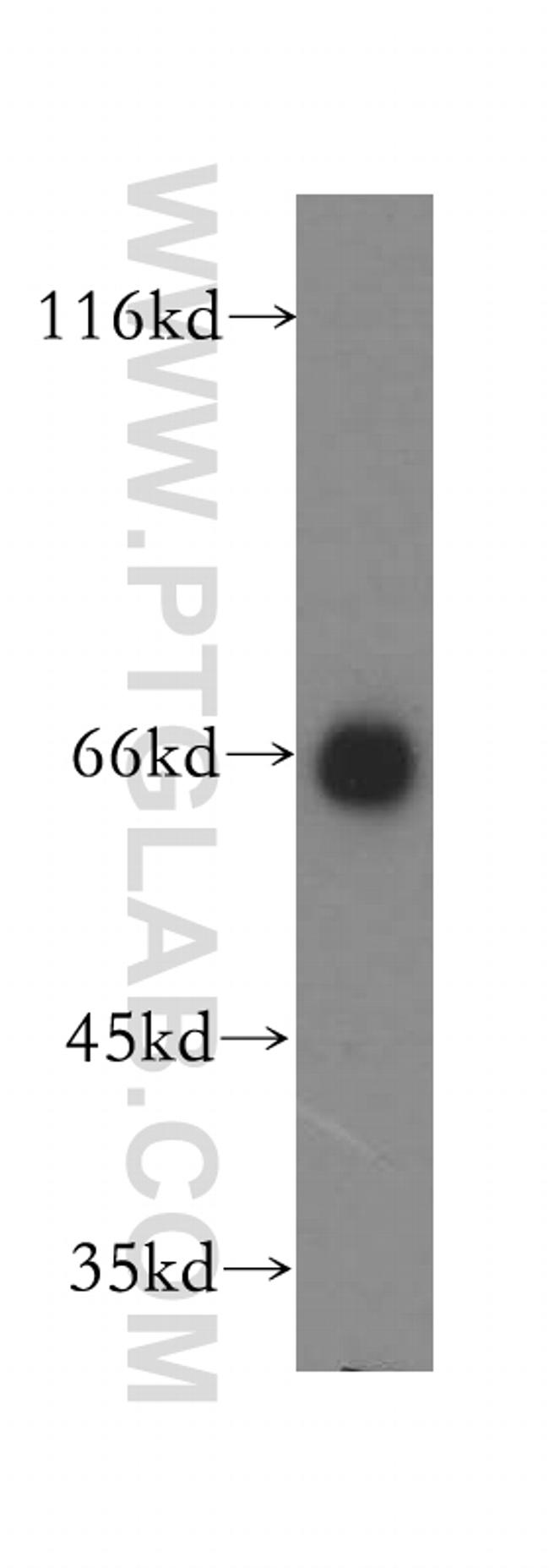 IMP5 Antibody in Western Blot (WB)