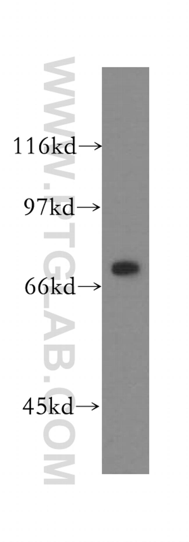 IMP5 Antibody in Western Blot (WB)