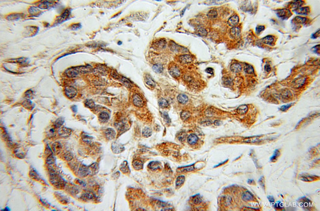 CaMKII gamma Antibody in Immunohistochemistry (Paraffin) (IHC (P))