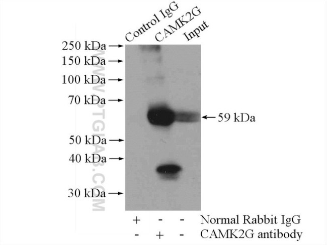 CaMKII gamma Antibody in Immunoprecipitation (IP)