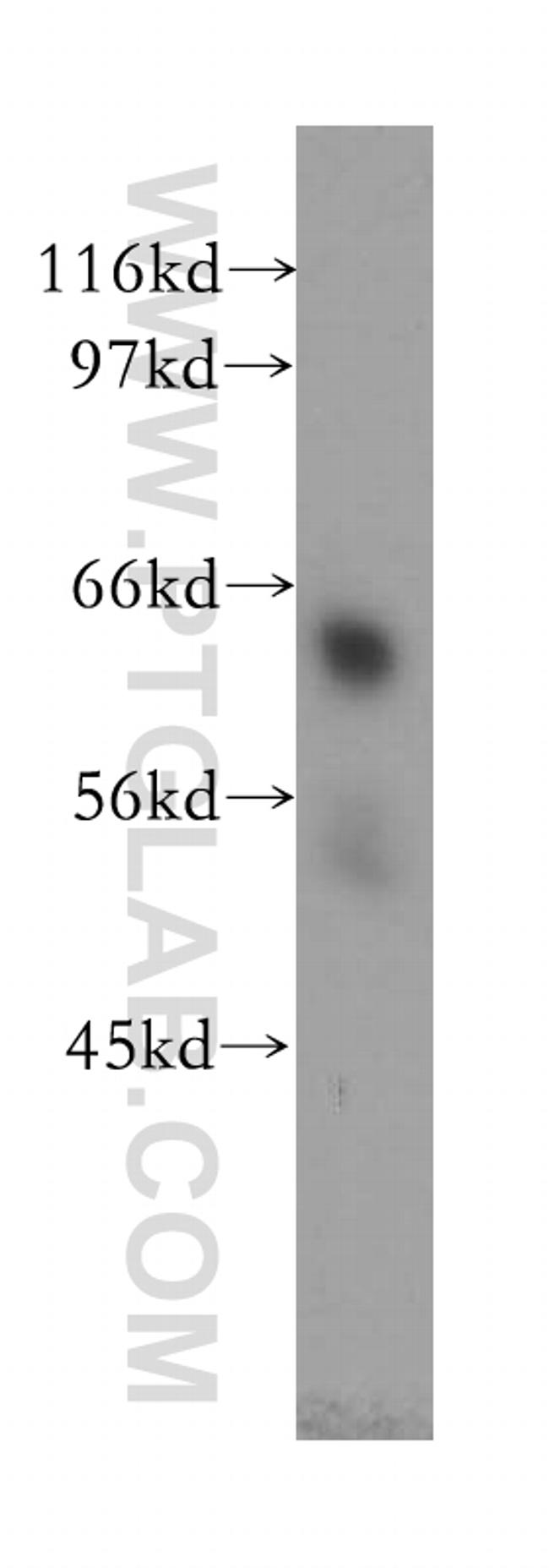 TULP2 Antibody in Western Blot (WB)