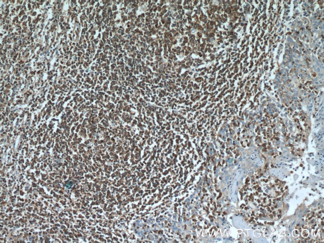 SHCBP1 Antibody in Immunohistochemistry (Paraffin) (IHC (P))