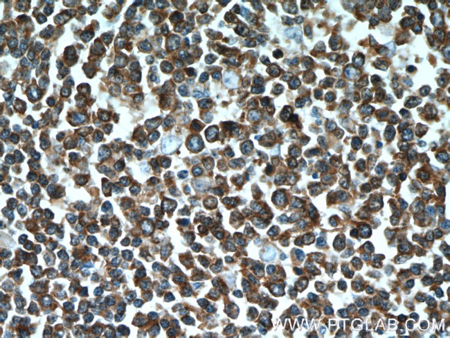 SHCBP1 Antibody in Immunohistochemistry (Paraffin) (IHC (P))