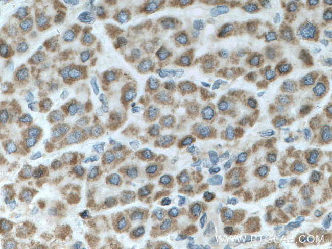 SHCBP1 Antibody in Immunohistochemistry (Paraffin) (IHC (P))