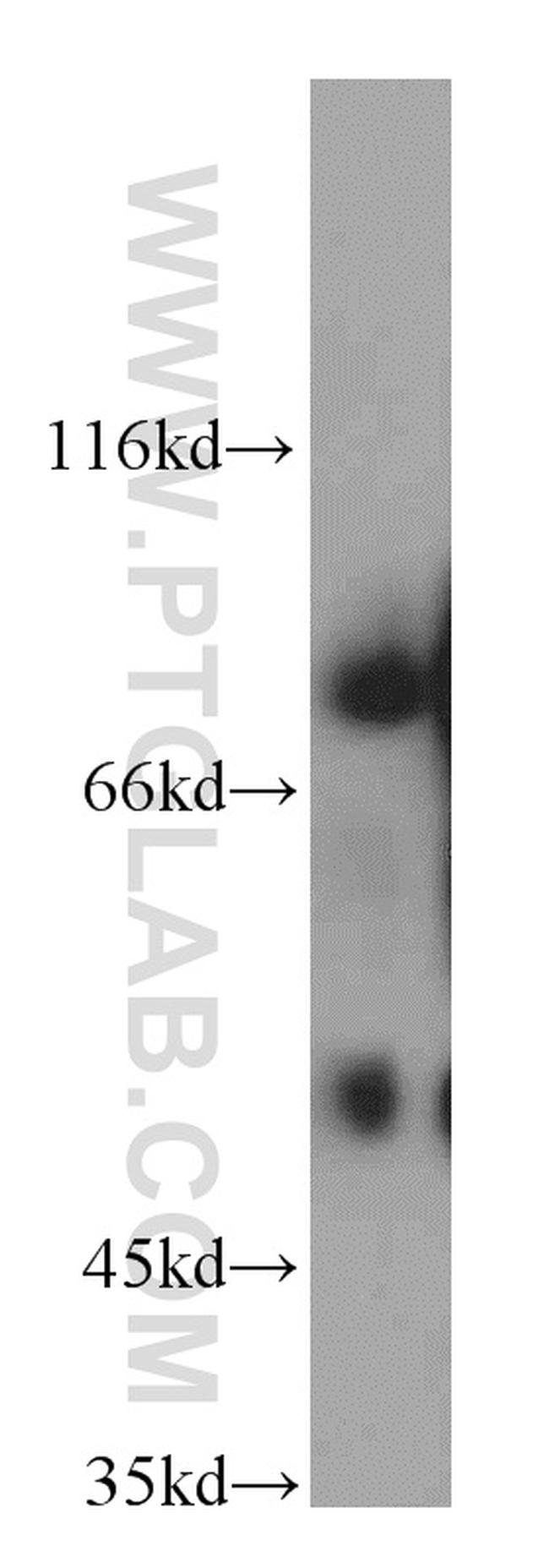 SHCBP1 Antibody in Western Blot (WB)