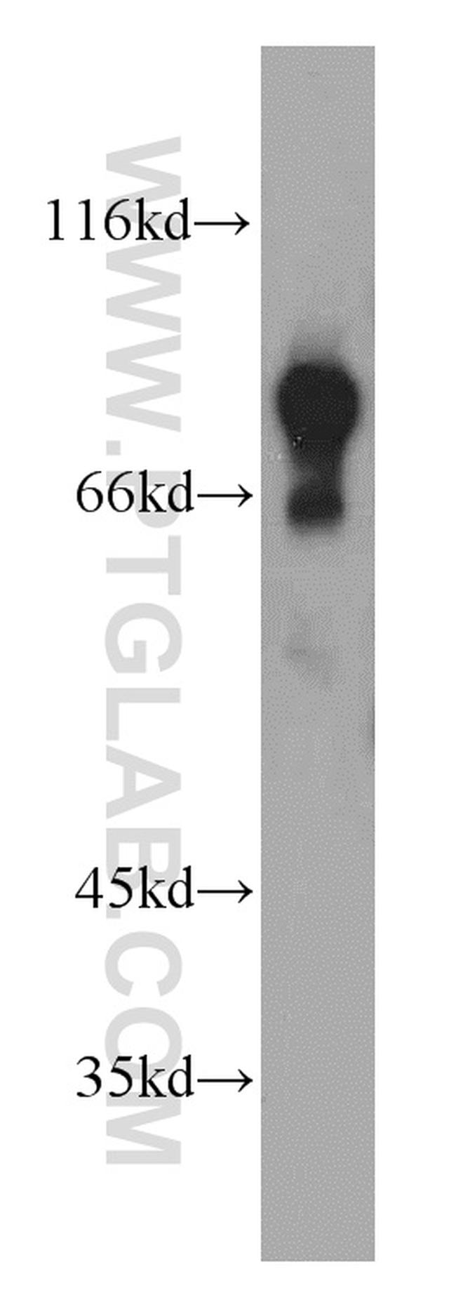 SHCBP1 Antibody in Western Blot (WB)