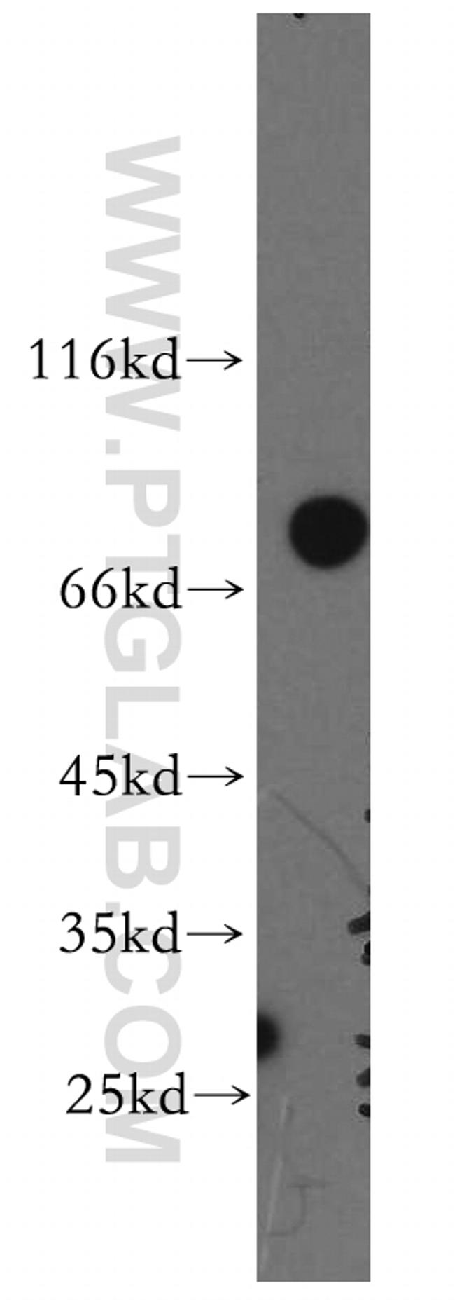 SHCBP1 Antibody in Western Blot (WB)