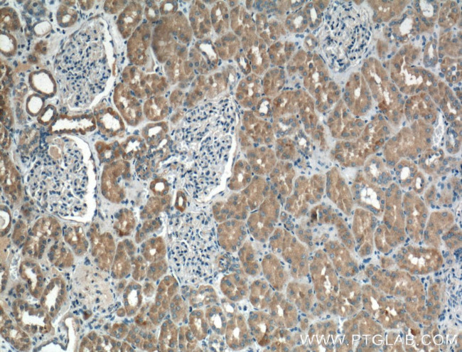 BBS3 Antibody in Immunohistochemistry (Paraffin) (IHC (P))