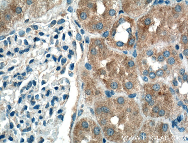 BBS3 Antibody in Immunohistochemistry (Paraffin) (IHC (P))