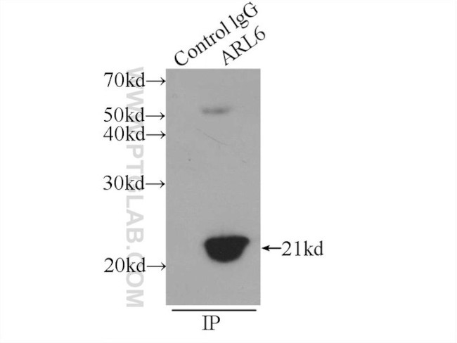 BBS3 Antibody in Immunoprecipitation (IP)