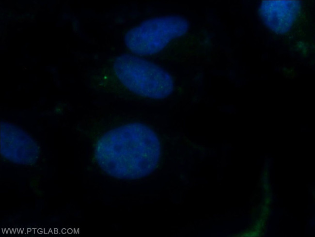 BBS3 Antibody in Immunocytochemistry (ICC/IF)