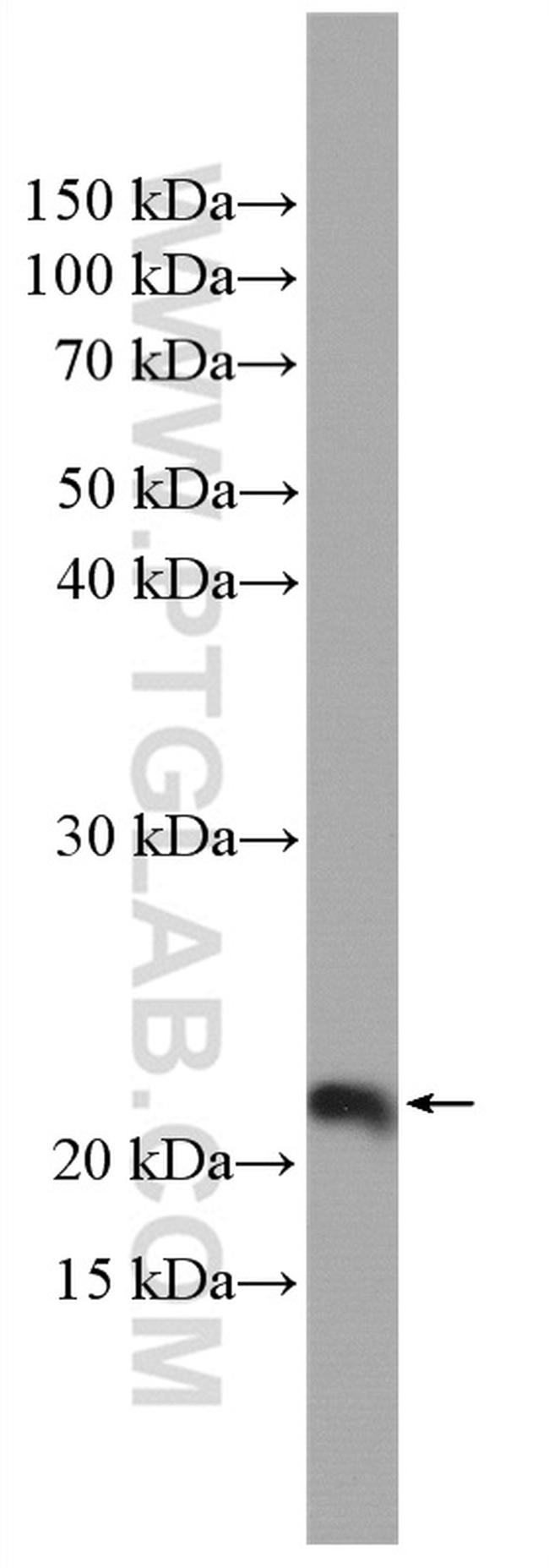 BBS3 Antibody in Western Blot (WB)