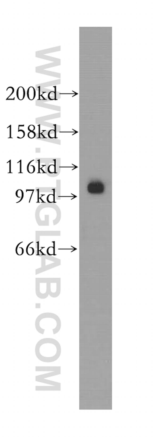 SALL2 Antibody in Western Blot (WB)